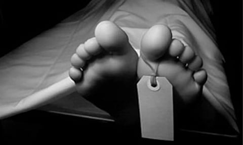 Representative Image