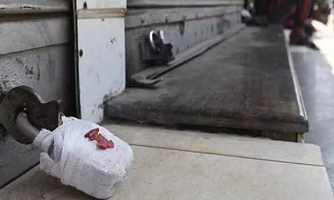 Representative image