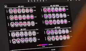 Representative image (Photo/Reuters)