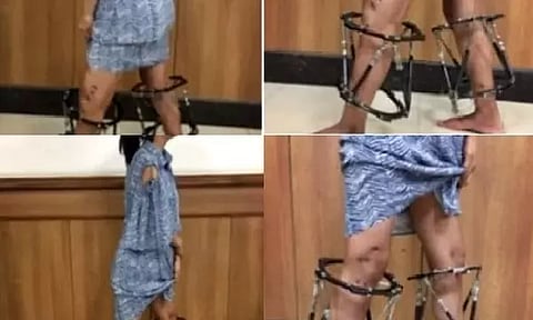 Ayesha's legs (IANS)