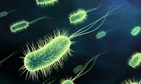 Representative Image