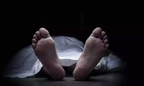 Representative Image