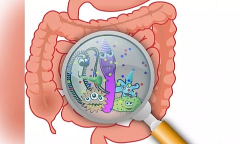 Representative Image