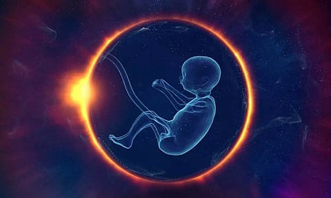 Representative image