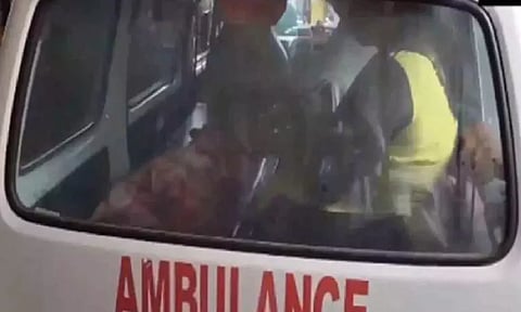 Representative image