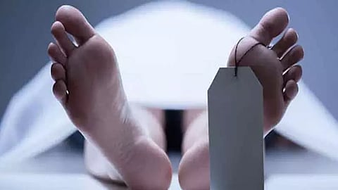 Representative Image