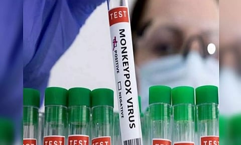 Representative Image (ANI)