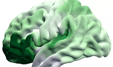 Our Bigger Brains Came With a Downside: Faster Aging