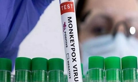 Representative Image (ANI)