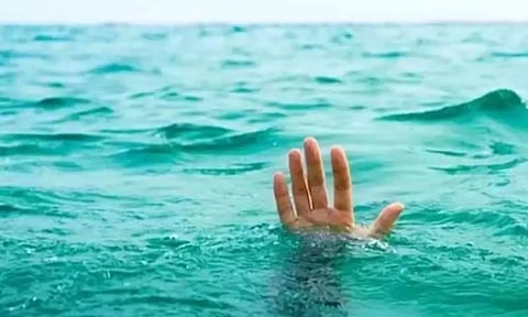 Representative Image