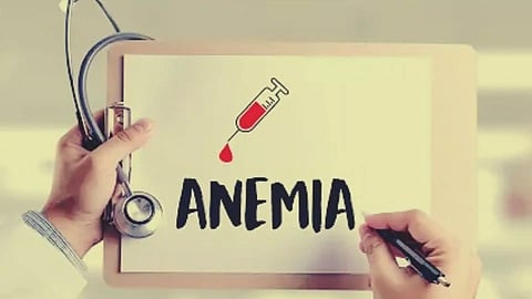 Representative anemia image&nbsp;