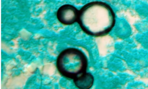 Representative Image (IANS)