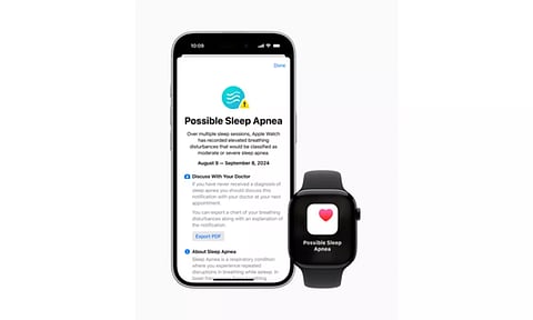 Sleep apnoea alert feature on Apple Watch gets US FDA approval