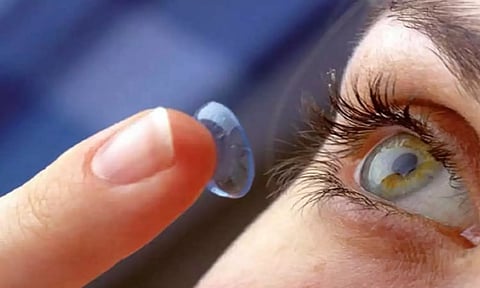 Representative image