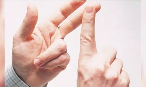 Representative image