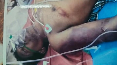 Prabhu, one of the accused in the case, at the hospital