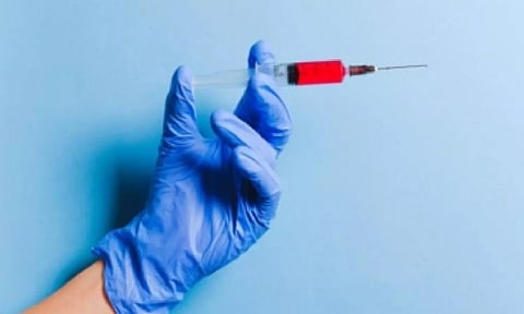 Representative image