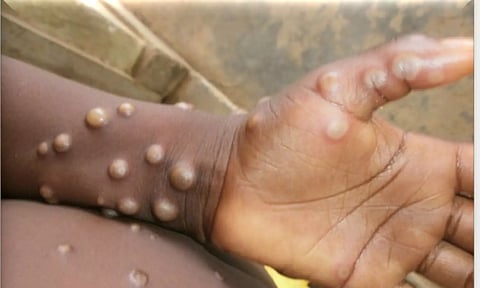 Representative Image