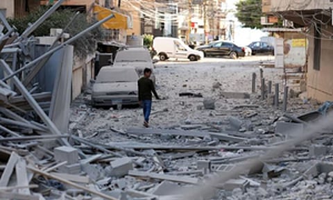 Representative image