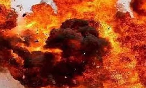 Representative Image&nbsp;