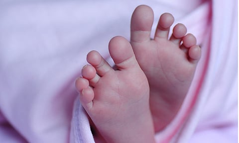 Representative image