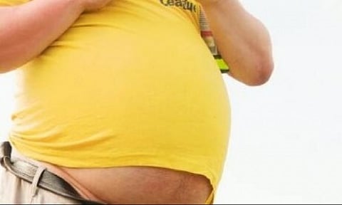 Representative image