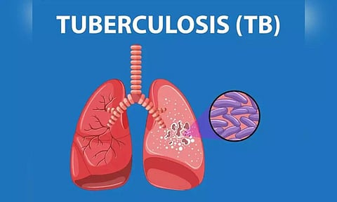 Representative Image&nbsp;