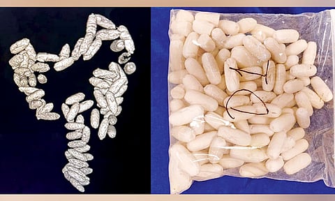 Seized 1.24 kg of cocaine; capsules removed from the stomach of Kenyan woman air passenger