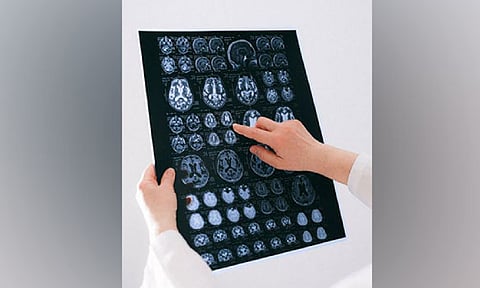 Representative Image (Image source: Pexels)