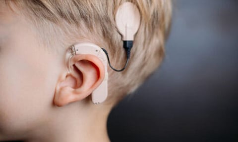 Representative image