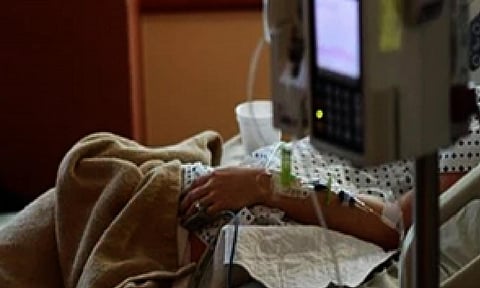 Representative image