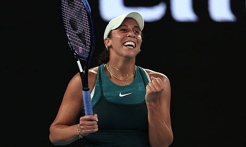 &nbsp;Aryna Sabalenka