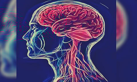 Representative image