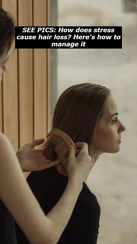 SEE PICS: How does stress cause hair loss? Here's how to manage it