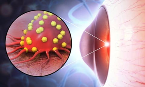 Representative Image&nbsp;