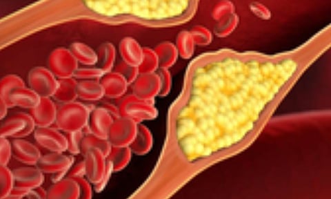 Representative Image (IANS)