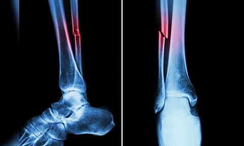 Representative Image (IANS)