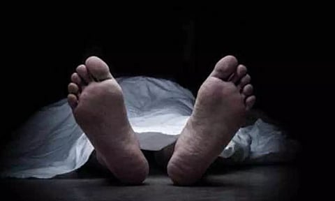 Representative Image