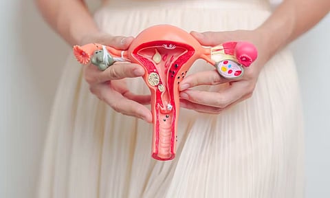 Representative Image