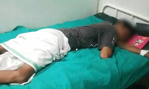 Chennai student injured by acid&nbsp;