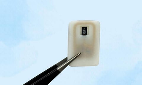 Representative Image&nbsp;