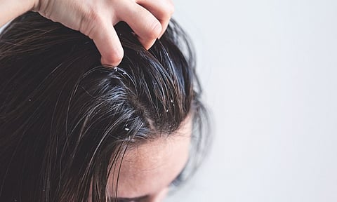 Representative Image&nbsp;