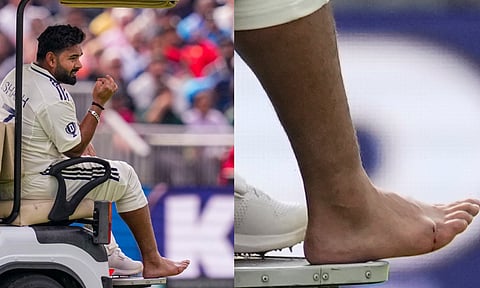 India's Rishabh Pant's feet after an injury on day one of the fourth test cricket match between India and England, at the Old Trafford Cricket Ground, in Manchester, on July 23, 2025 (PTI)
