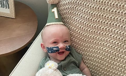 Most premature baby turns one with a Guinness entry (Guinness world records)