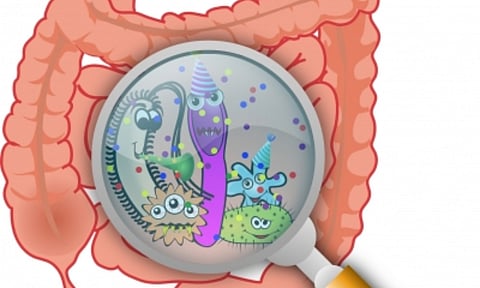 A pill to change gut microbiome key to fight obesity (IANS)