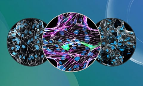 Malaria parasite damages brain (IANS)