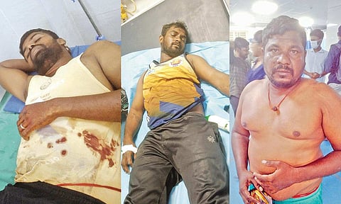 &nbsp;Fishermen have been admitted to the Orathur Government Medical College Hospital