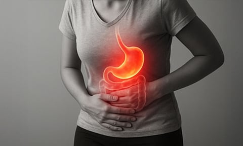 Irritable bowel syndrome (IANS)