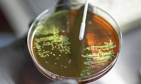 Representative image for infection (IANS)