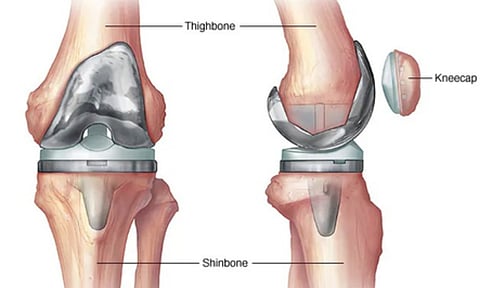 Representative Image (IANS)